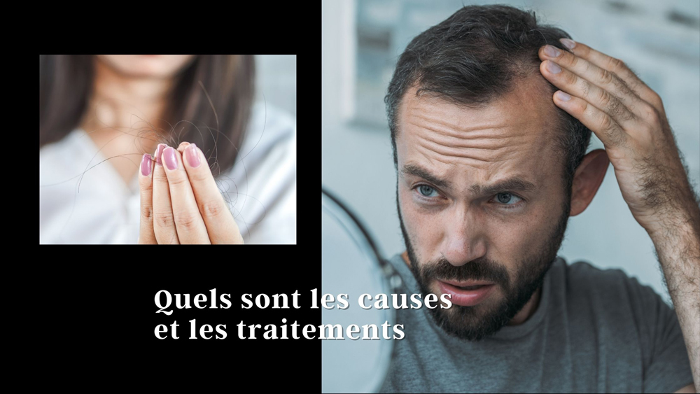 Homme inspectant son cuir chevelu clairsemé et femme avec des cheveux aux bouts des doigts