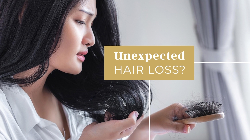 Women with hair brush full of falling hair